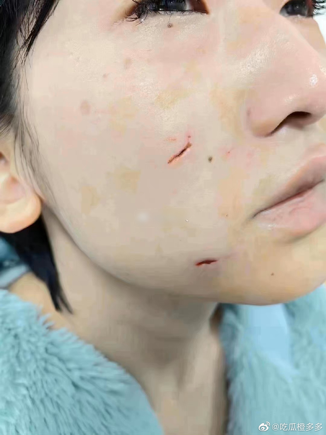 妹子事後上傳破相照。（翻自微博）