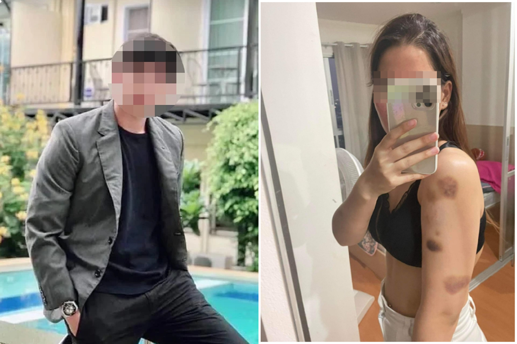 富二代竟是變態！約砲女網友卻恐怖性虐，把她下體當生猛海鮮狠咬啃爛。（翻自《Sanook》）