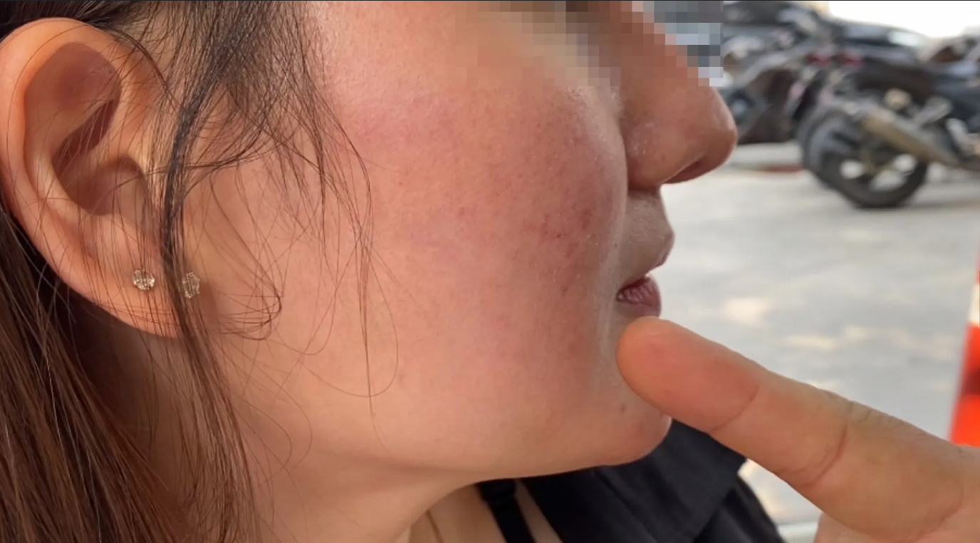 甜蜜約砲卻變調，女子指控遭到男方暴力性虐。（翻自《Sanook》）