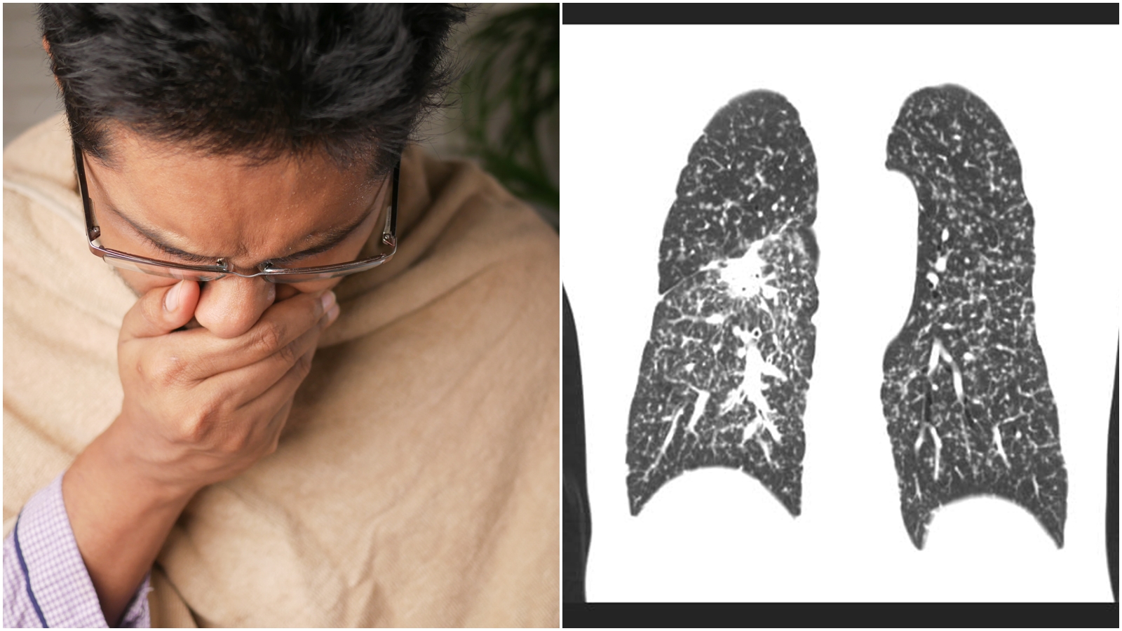 蘇一峰強調，有家族遺傳史有特別注意，否則當發現時可能就來不及；左為示意圖，非當事人。（pexels／攝影師：Towfiqu barbhuiya、翻攝自蘇一峰臉書）