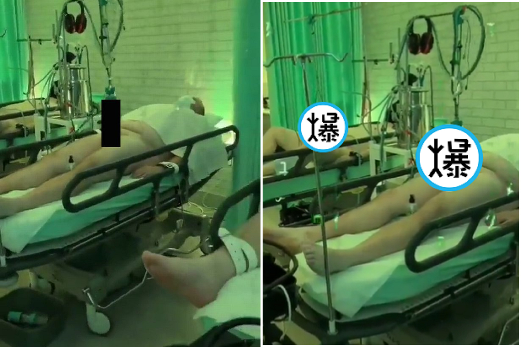 取精影片嚇死人！生殖器套管瘋狂上下戳戳戳，「中國式榨精」真相曝光。（翻自推特）