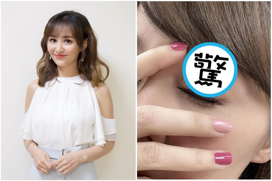 主播陳家頤透露被家暴，原來是被兒子丟玻璃奶瓶砸到所致。（翻攝自陳家頤臉書）