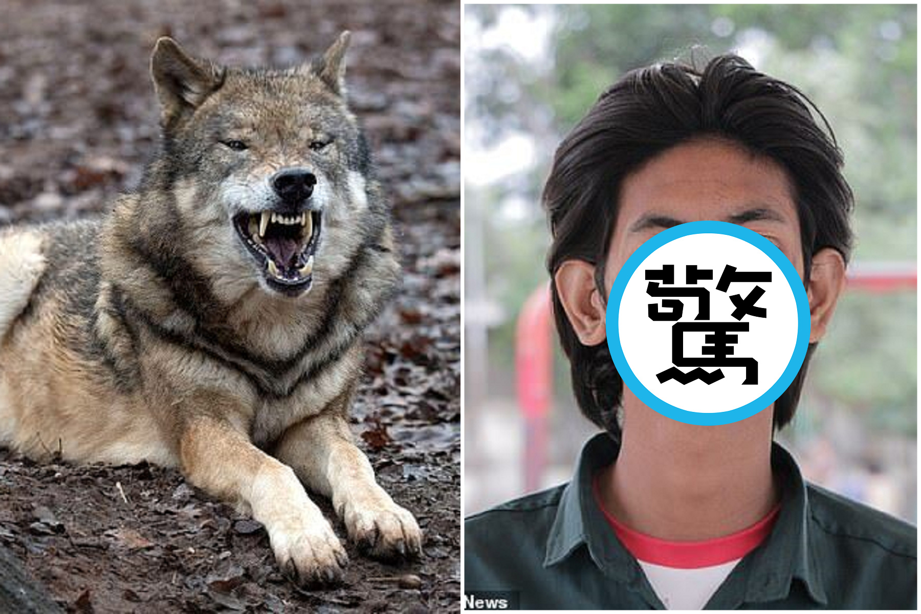 野生動物就是這麼恐怖！他兒時被野狼叼走咬爛臉，面部全變形終身被譏「鬼男」。（翻自《每日郵報》）