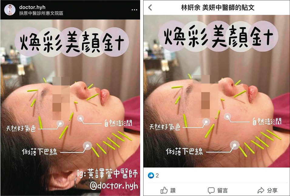中醫師黃譯萱(左)指控林妍余多次盜用她的圖文(如右),侵害肖像權及著作權。(翻攝黃譯萱中醫師臉書)