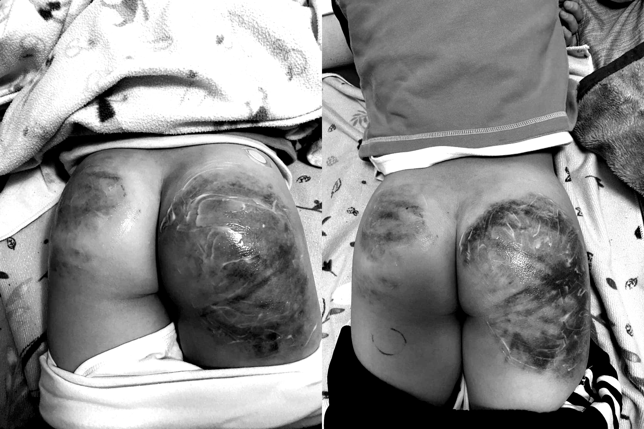 一名母親指控,將兒子送去新竹市某間跆拳道道館,兒子卻慘遭教練毒打。(翻攝自新竹人有事嗎臉書社團)