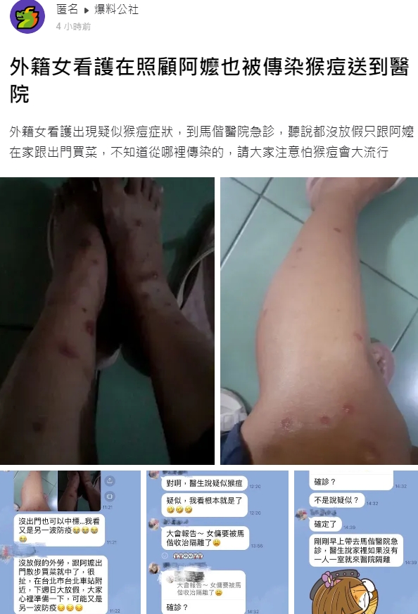 有網友在爆料公社發文，宣稱一名外籍女看護在照顧阿嬤期間感染猴痘。（翻攝自爆料公社）