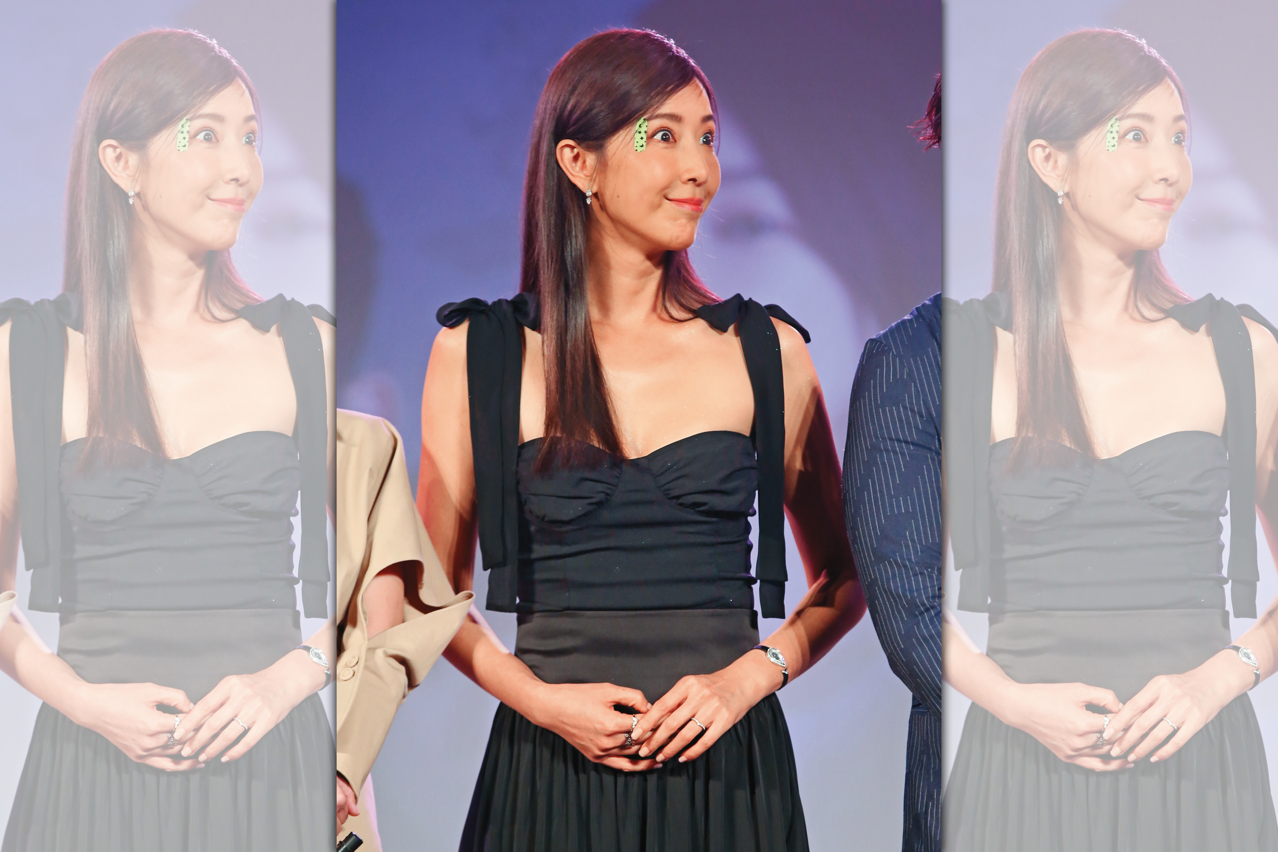 隋棠右眼上的OK繃頗吸眼球，J個「破相時尚」感覺會紅。（母湯）