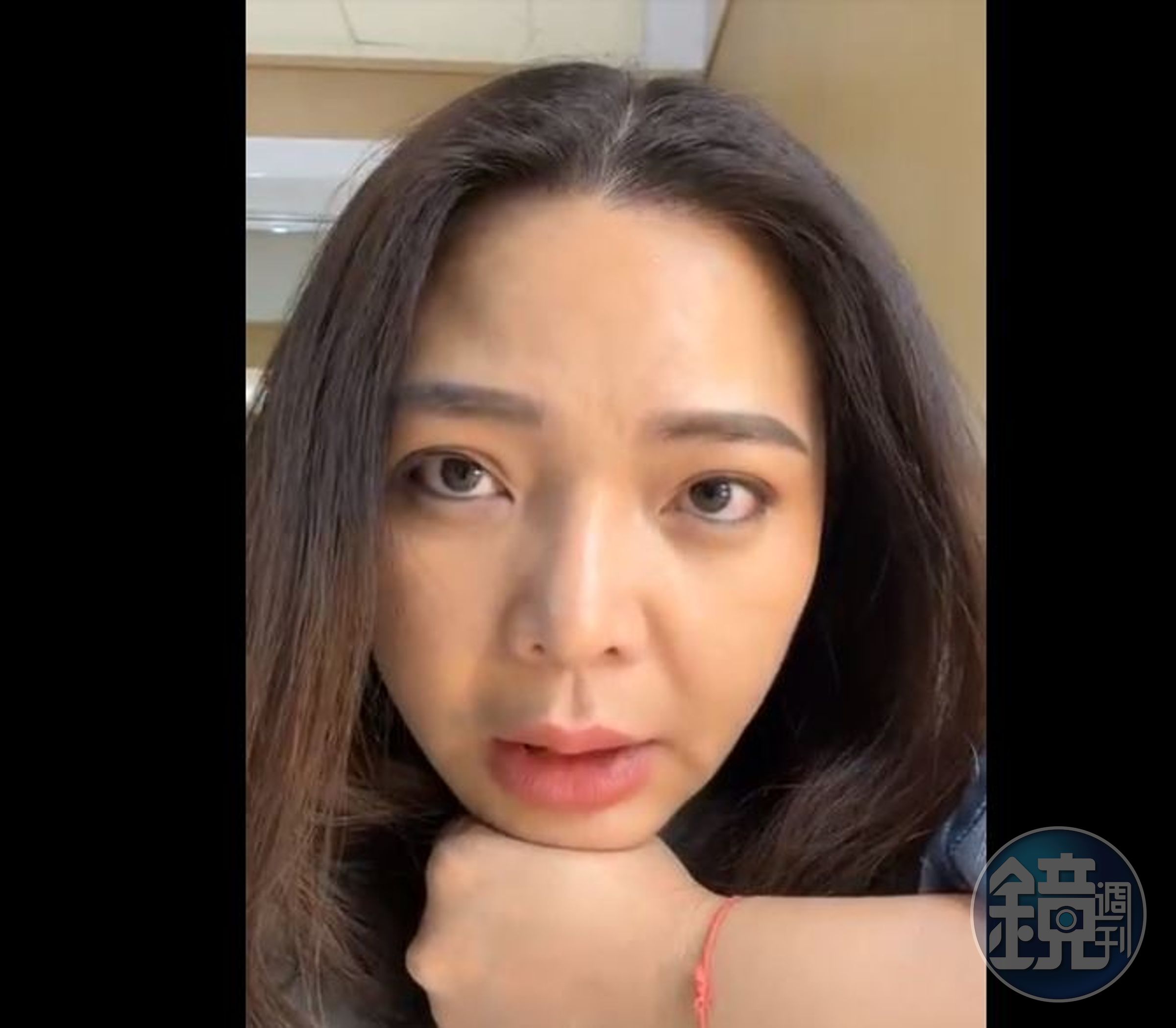 小甜甜頻頻開直播澄清，卻始終不願露出狗狗受傷位置。（翻攝自小甜甜臉書）