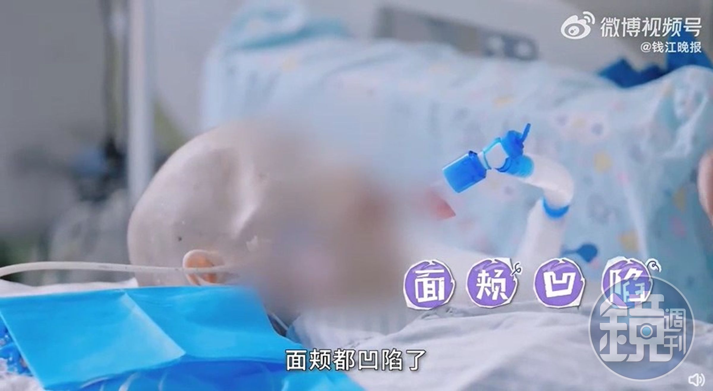 15歲少女為愛減肥，50多天不進食！瘦成皮包骨終慘死。（翻自微博）