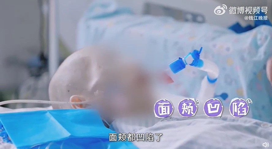 15歲少女為愛減肥，50多天不進食！瘦成皮包骨終慘死。（翻自微博）