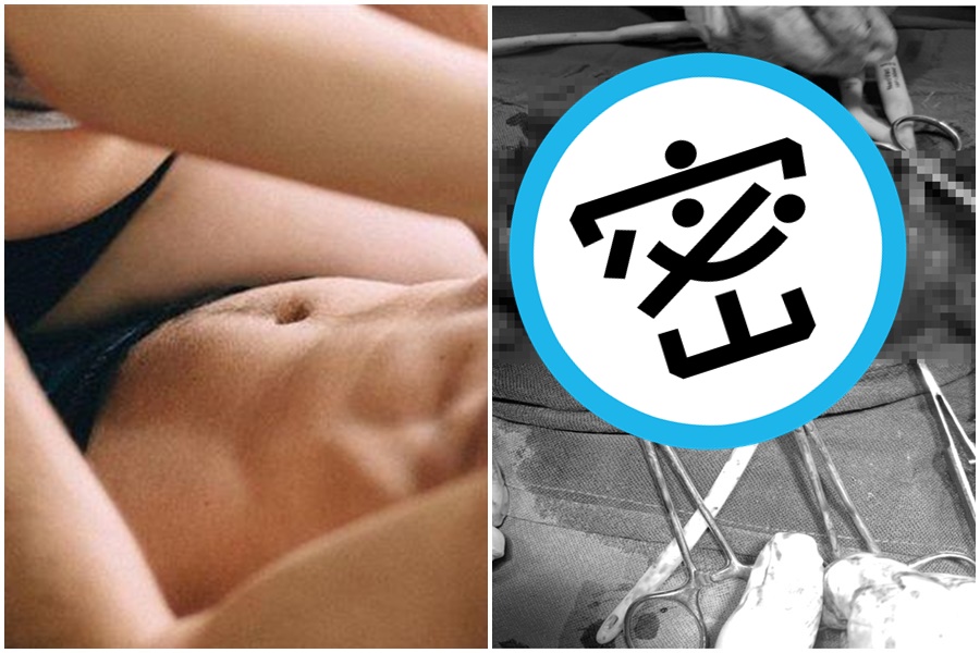 坦尚尼亞一名男子在激烈性愛過程中GG突然滑出伴侶陰部，害他下體當場斷成3節。（示意圖，Pixabay／翻攝自IJSCR網站）