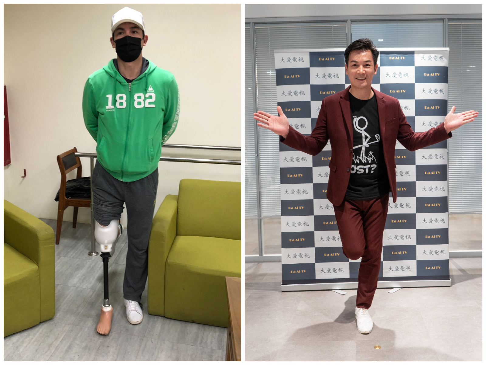 伊正拍戲時戴上義肢道具幾可亂真。（大愛提供）