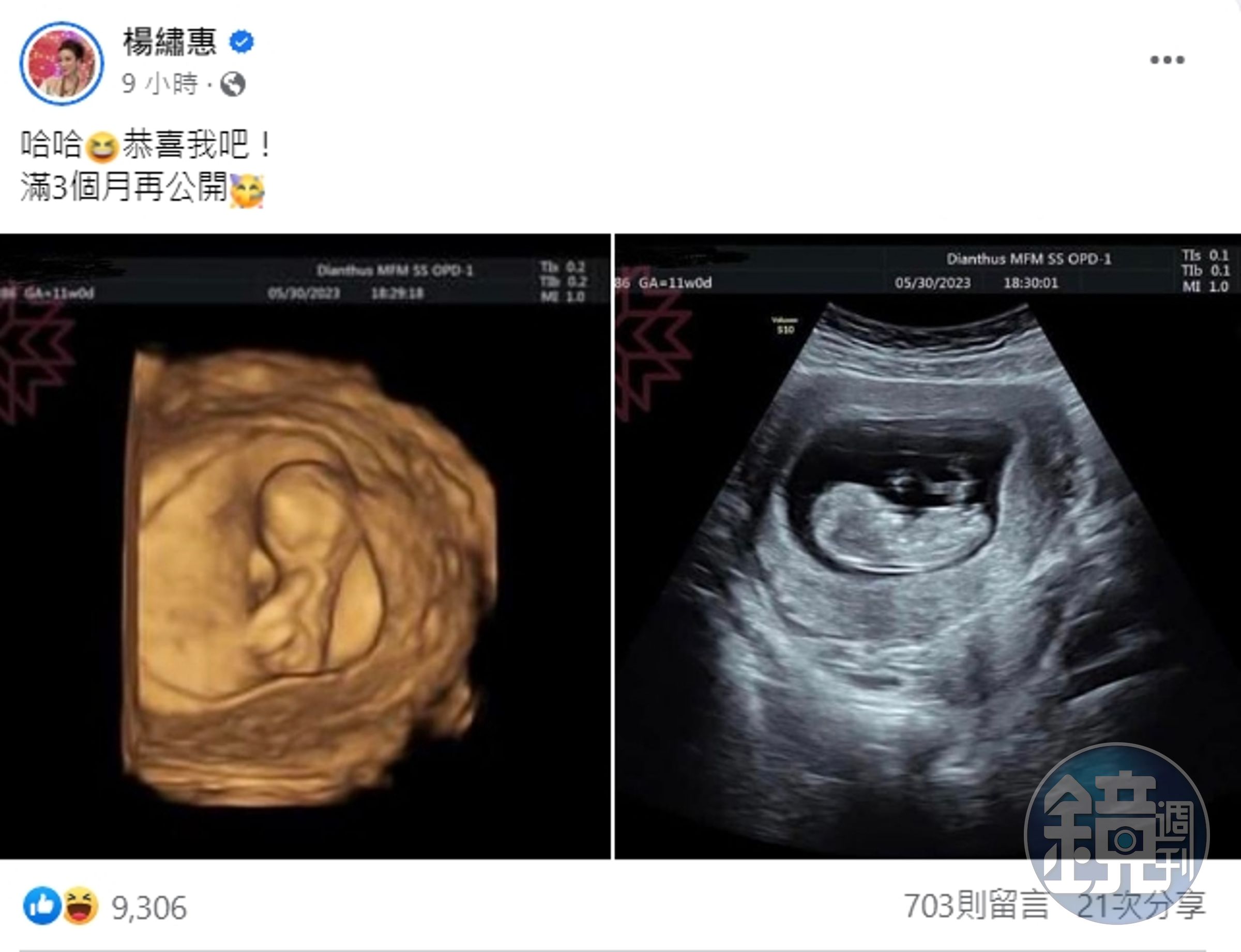 楊繡惠曬出兩張超音波照喊「恭喜我吧!」(翻攝自楊繡惠臉書)