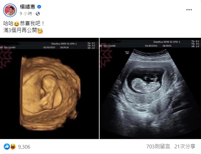 楊繡惠曬出兩張超音波照喊「恭喜我吧！」（翻攝自楊繡惠臉書）