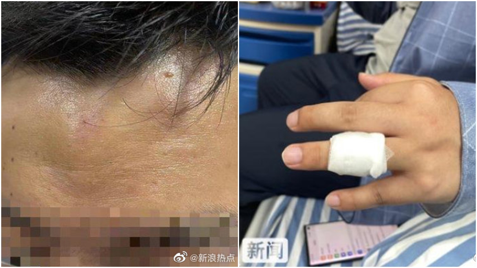 一名記者在採訪期間,無故遭警方圍毆。(翻攝自微博@新浪熱點)