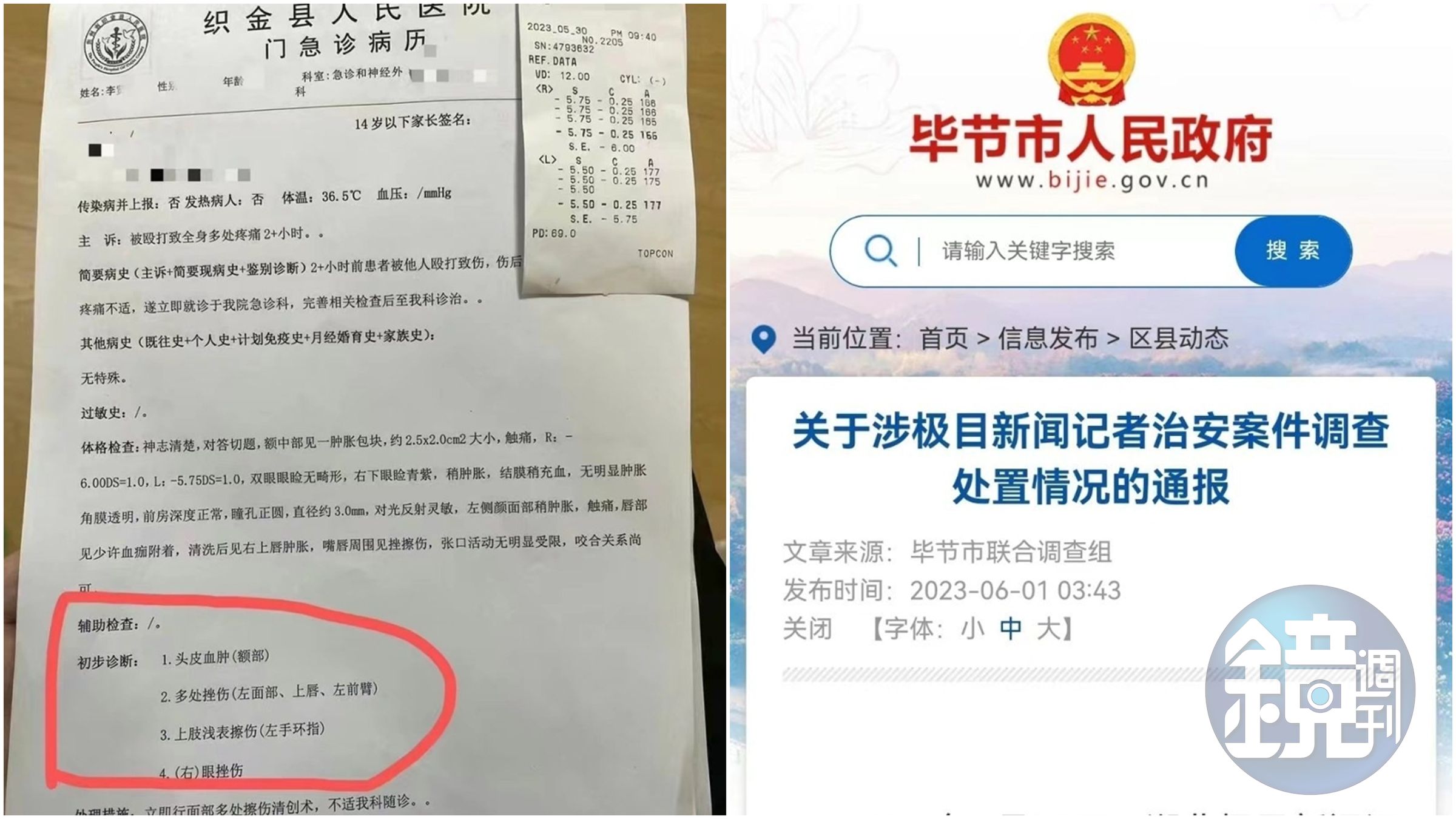 中國一名記者被警方圍毆後，引發相關機構關注。（翻攝自微博@新浪熱點）