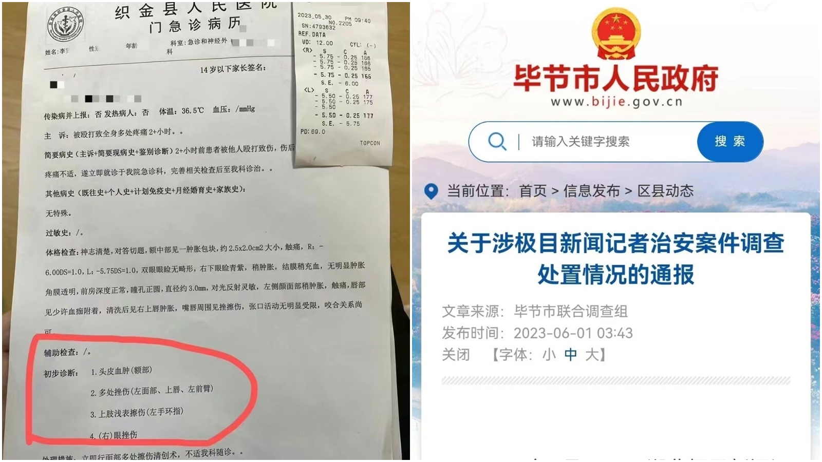 中國一名記者被警方圍毆後,引發相關機構關注。(翻攝自微博@新浪熱點)