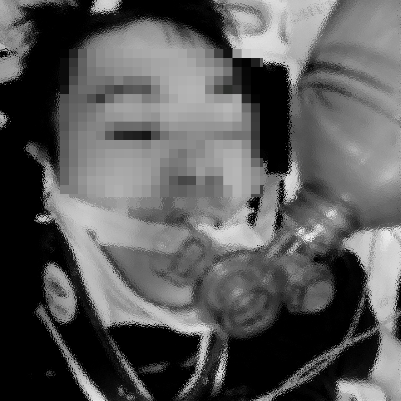賴生護頸內有軟墊,照片中可清楚看見護頸與脖子仍有些許縫隙,家屬質疑勒痕不太可能是護頸所致。(家屬提供)