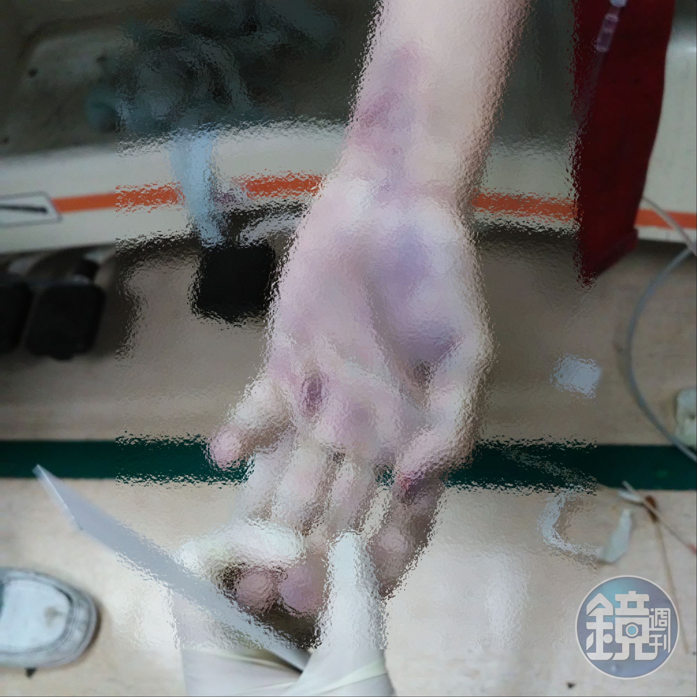 賴生左手拇指指甲處有疑似血漬。(家屬提供)