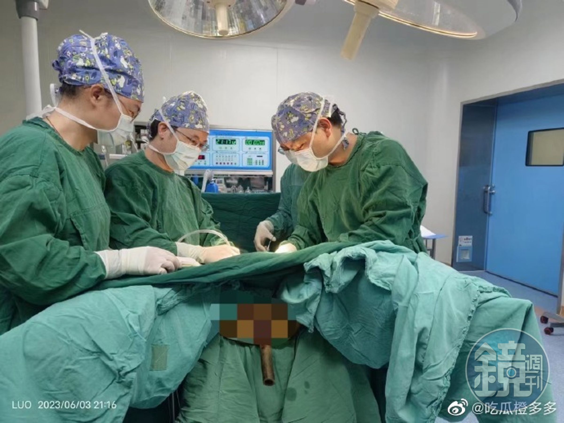 醫師為男子動手術。(翻自微博)