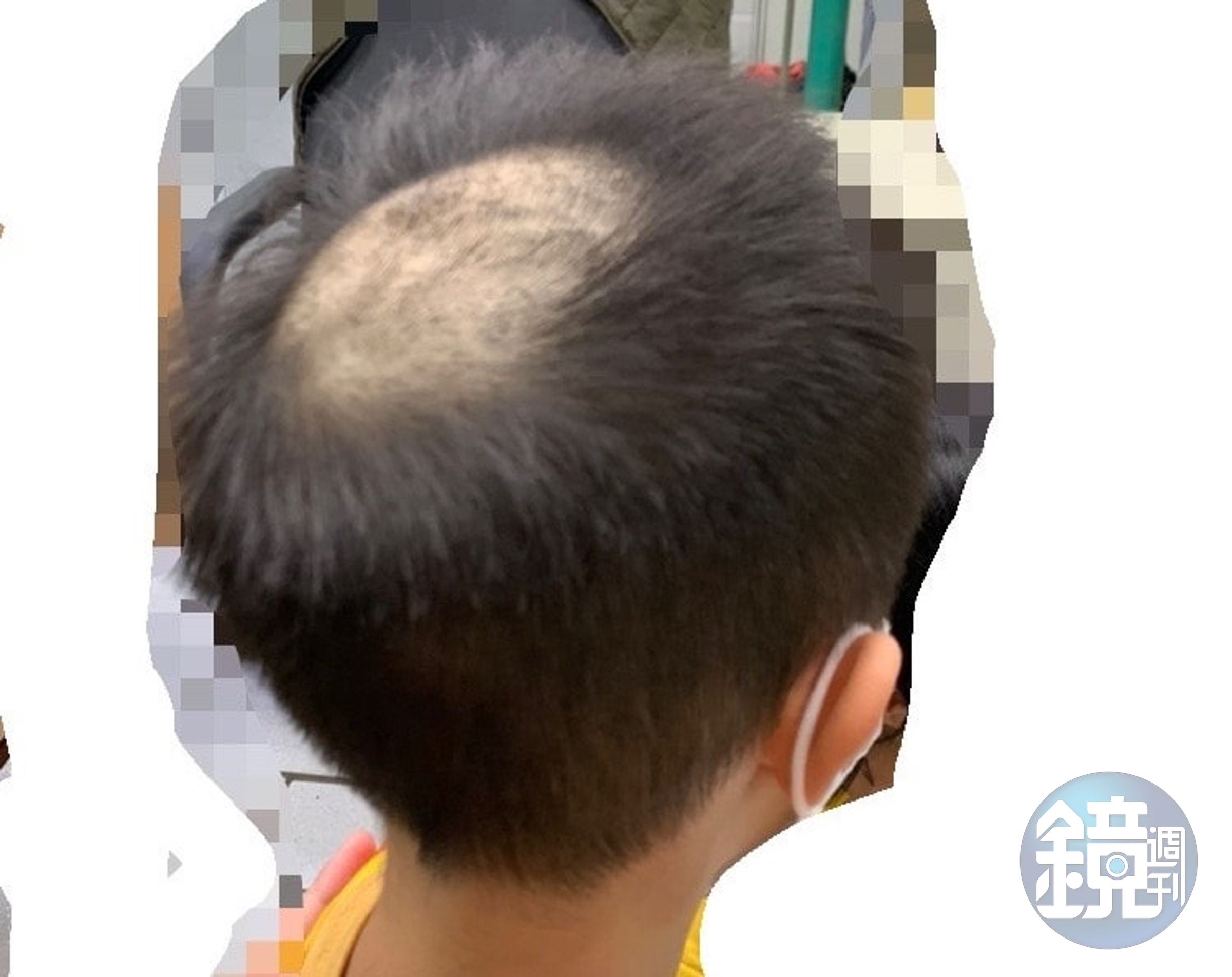 有網友Po出小孩驗髮變河童的慘況。（翻攝臉書社團）