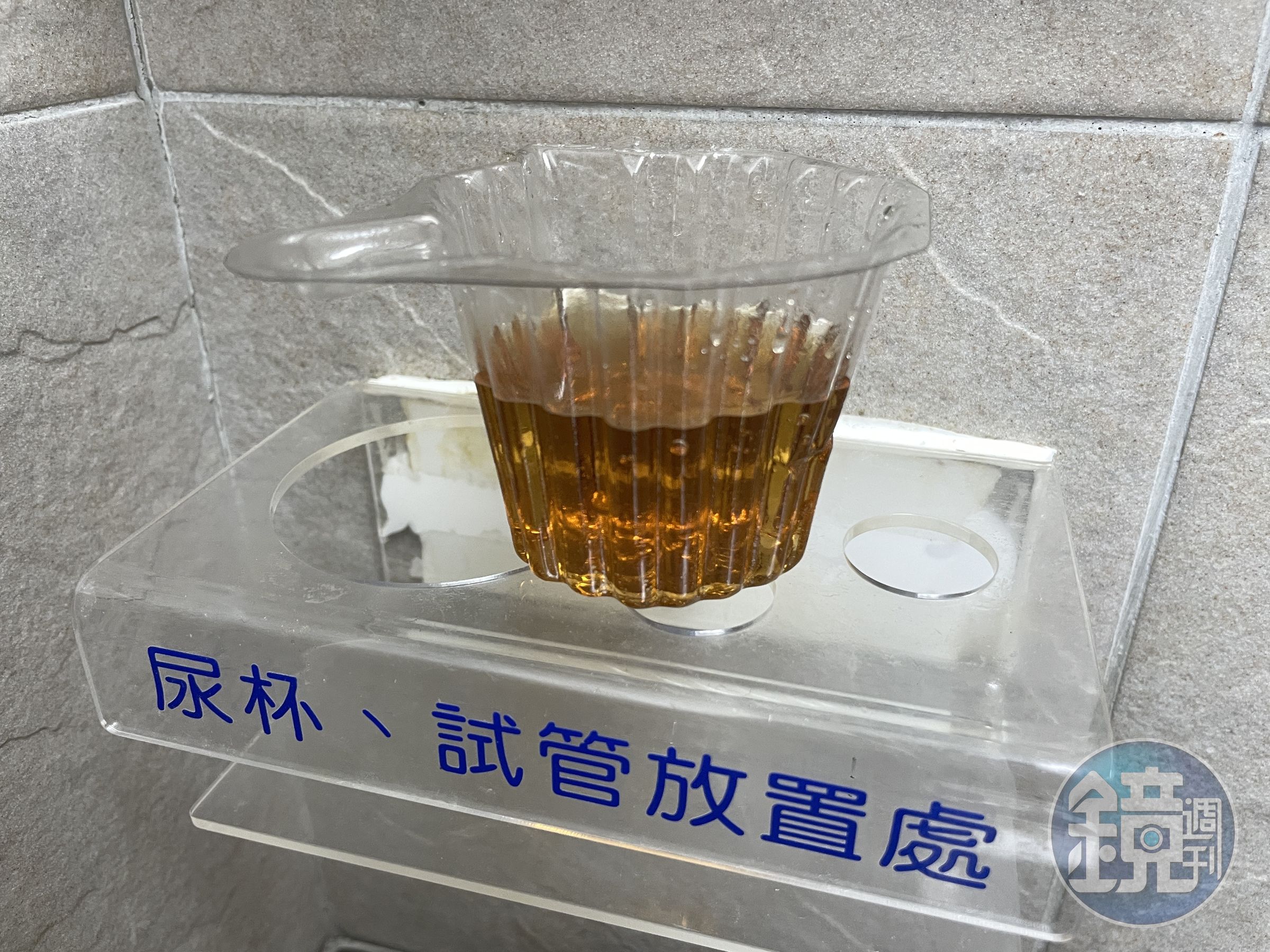 長期服用大量安眠藥,小心橫紋肌溶解症併發急性腎衰竭。(萬芳醫院提供)