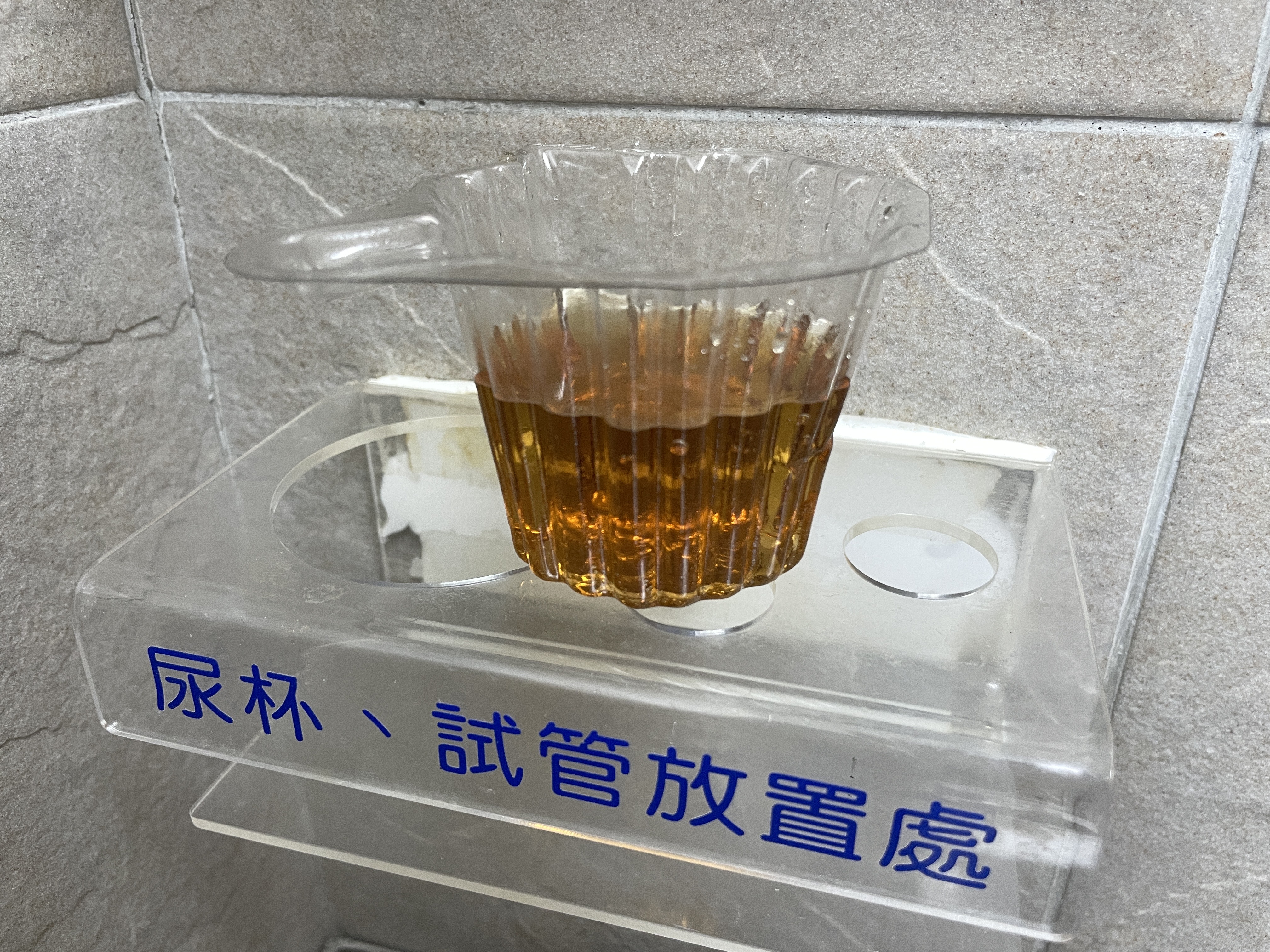 長期服用大量安眠藥，小心橫紋肌溶解症併發急性腎衰竭。（萬芳醫院提供）