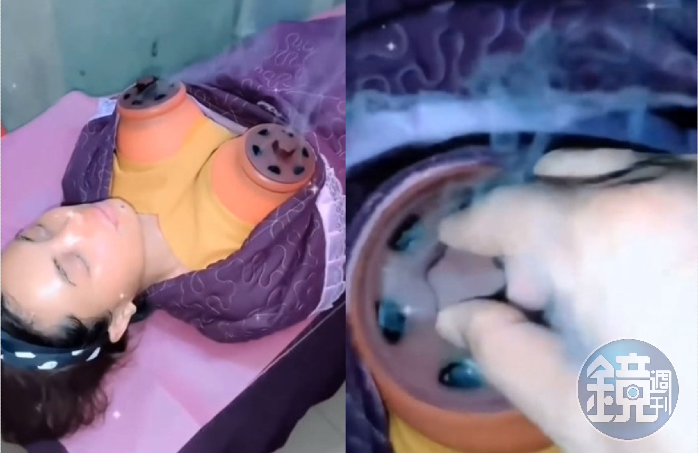 網路瘋傳一名女子疑似用民俗療法豐胸影片,影片中她胸部蓋上乳房造型器具,不時噴煙。(翻攝臉書社團「好fashion呀你」)