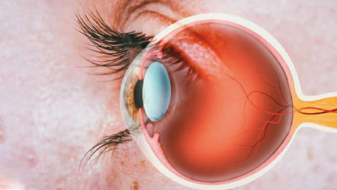 萊特生醫集團握有「人工玻璃體」技術，股東質疑臨床無進展。（翻攝源榮生技官網）