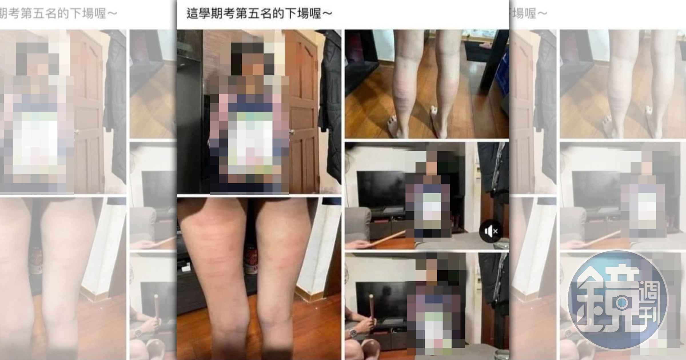 國小女童因考了第5名遭爸爸以藤條抽打40多下,雙腿滿是傷痕。(翻攝自臉書)