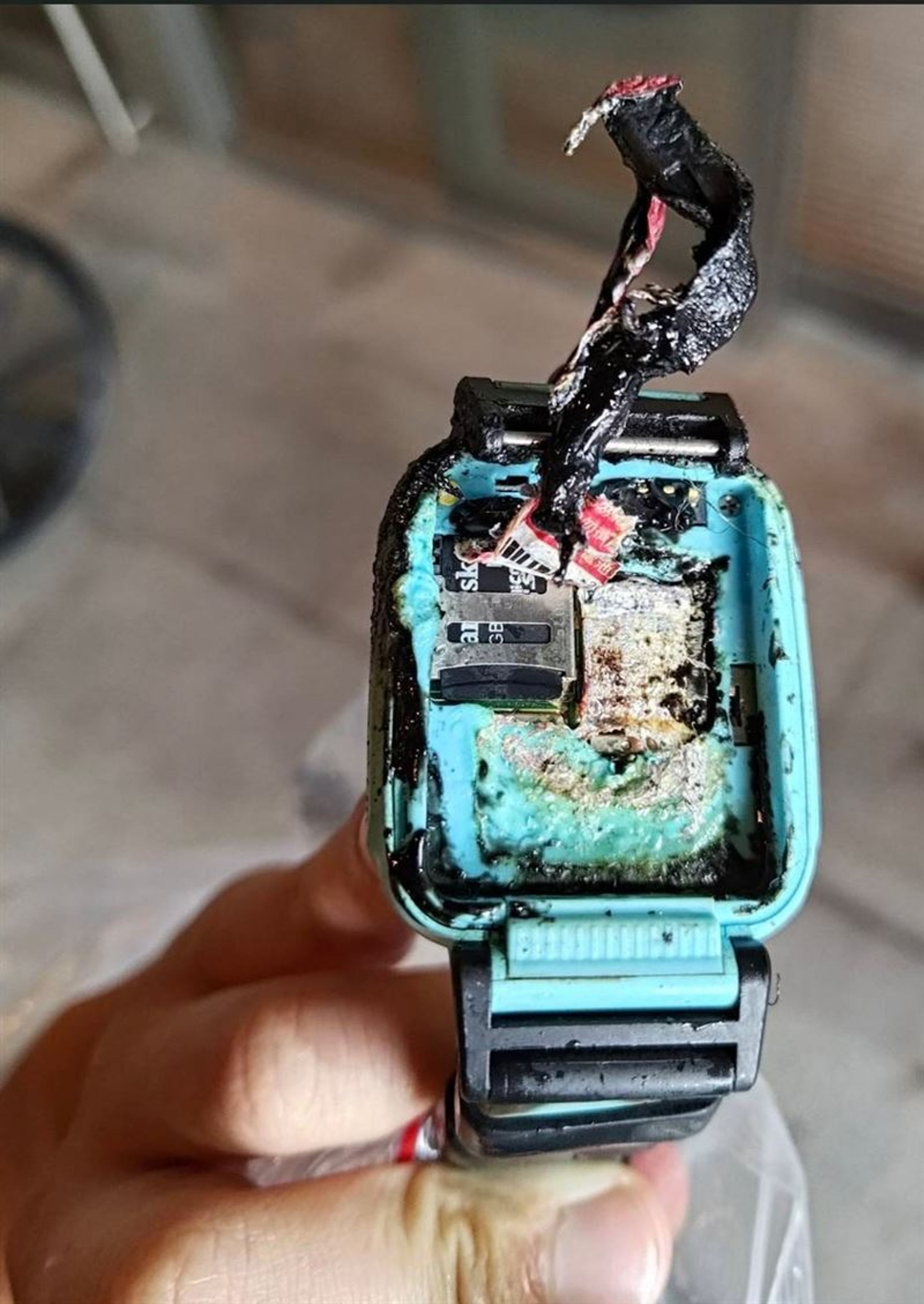 10歲男童戴在手上的智慧手錶突然爆炸燃燒，致其雙手燒燙傷。（翻攝畫面）