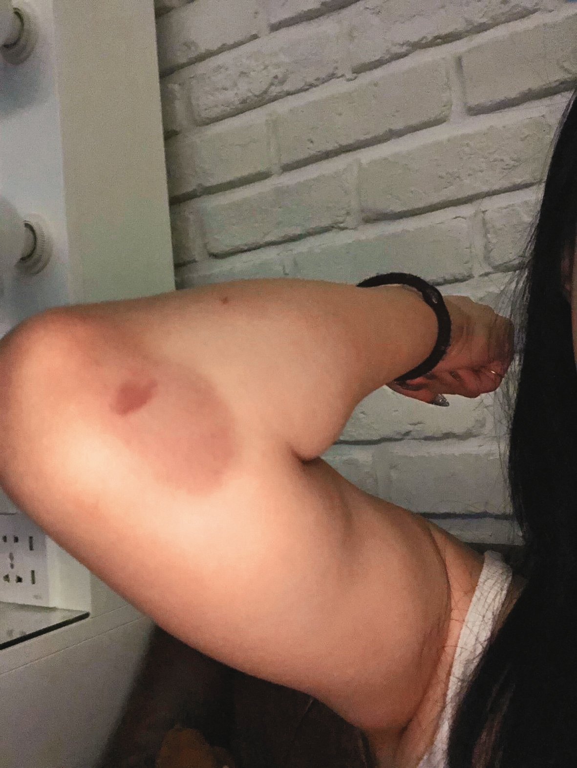 與陳慕交往後,直播主趙芸發現對方情緒不穩定時,不僅自傷也會傷害她。(趙芸提供)