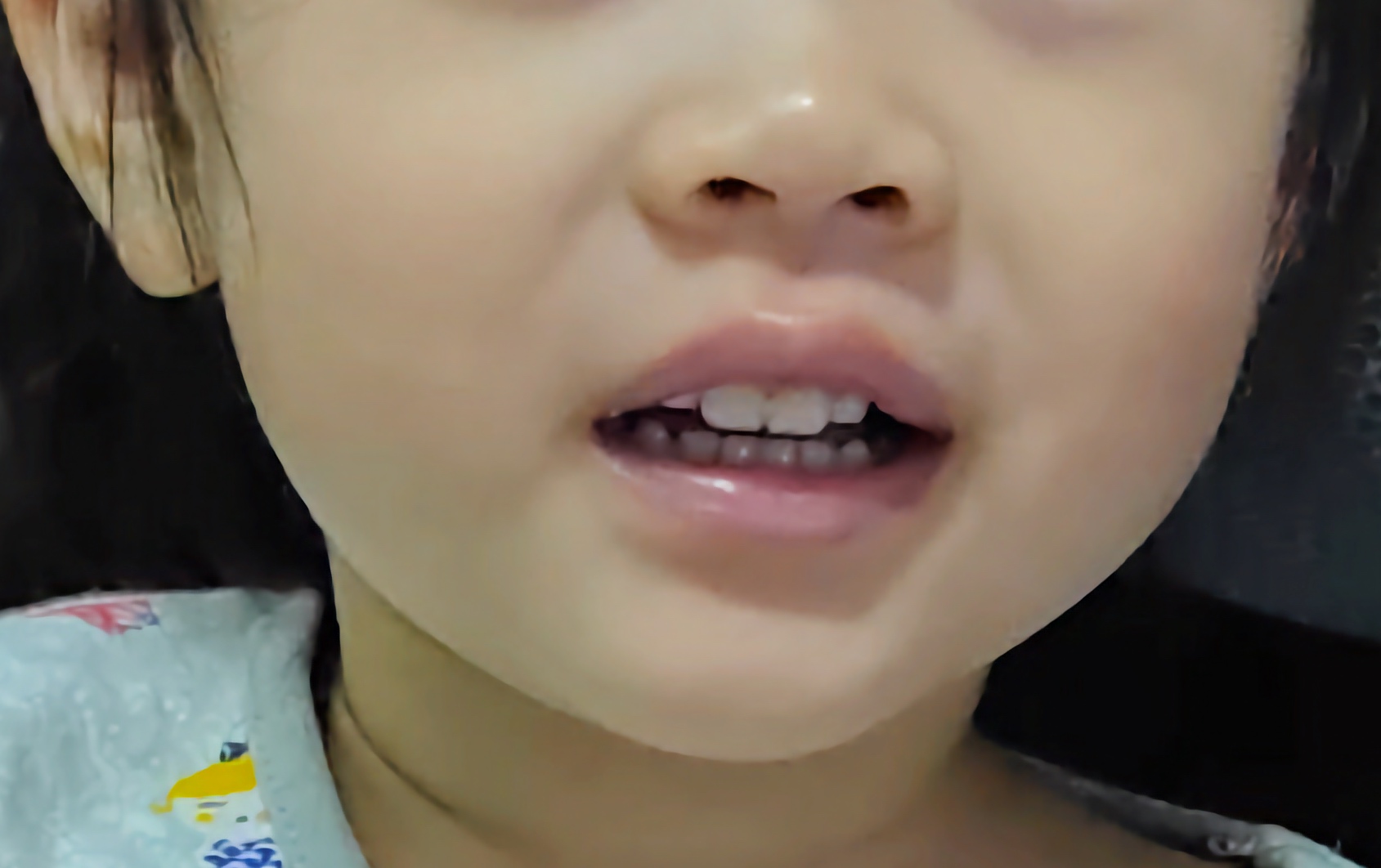 網友於網路上分享因婆婆愛給小孩吃糖，導致孩童的牙齒多數已蛀牙 （示意圖非當事人）