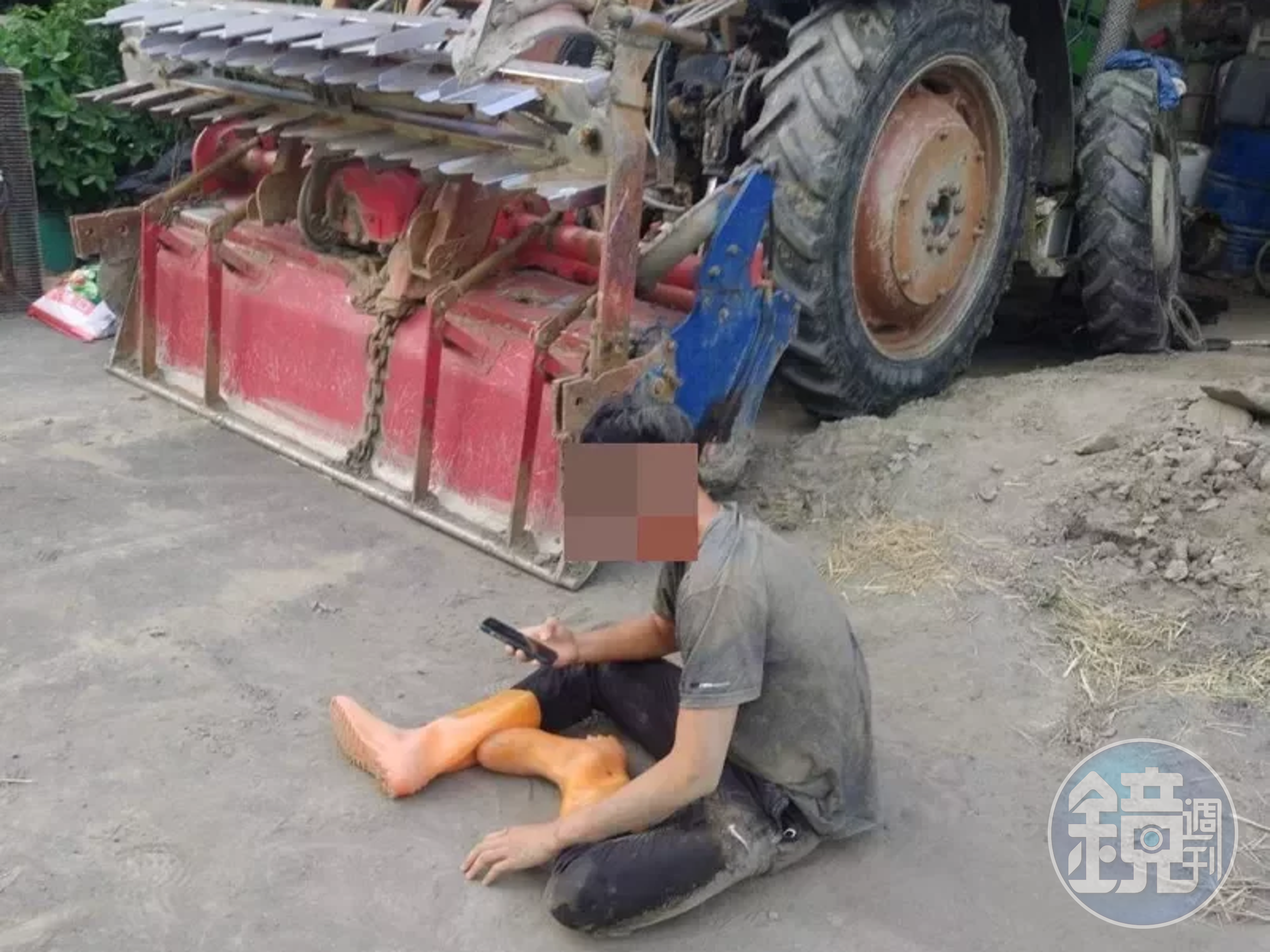 17歲高職生在路上騎腳踏車，卻遭經過的便衣警察誤以為是逃逸外籍移工，後來雙方展開追逐，害學生頭破血流縫了17針。（民眾提供）