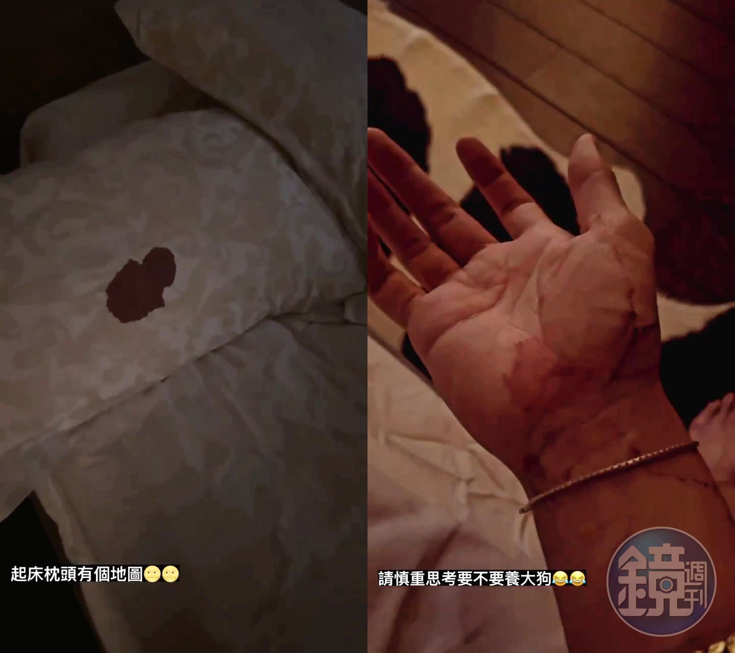 柯震東在IG限動貼出噴血驚悚照，除了枕頭的一大攤血跡，手上也有擦拭眼角流下的血痕。（翻攝自柯震東IG）