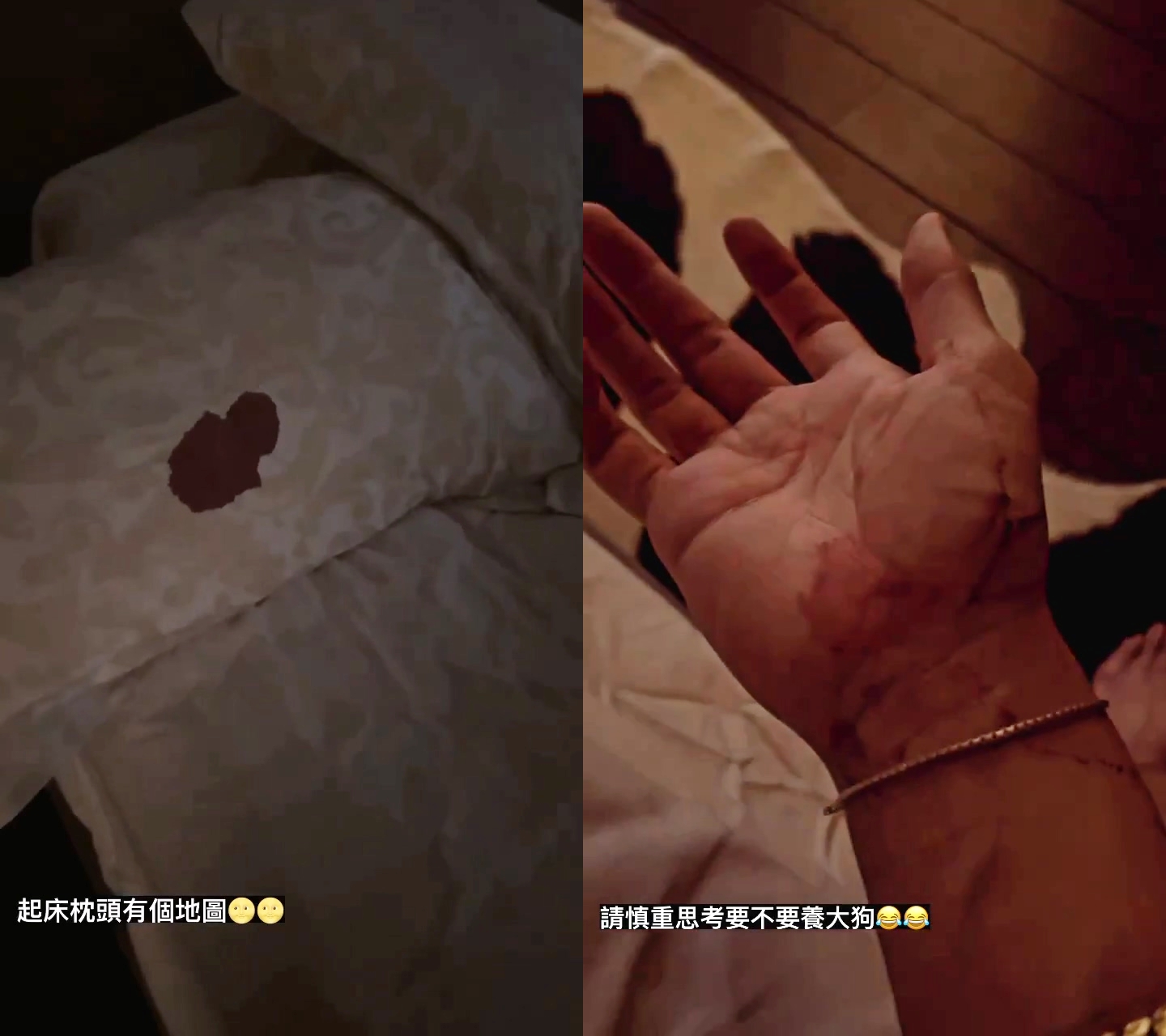 柯震東在IG限動貼出噴血驚悚照,除了枕頭的一大攤血跡,手上也有擦拭眼角流下的血痕。(翻攝自柯震東IG)