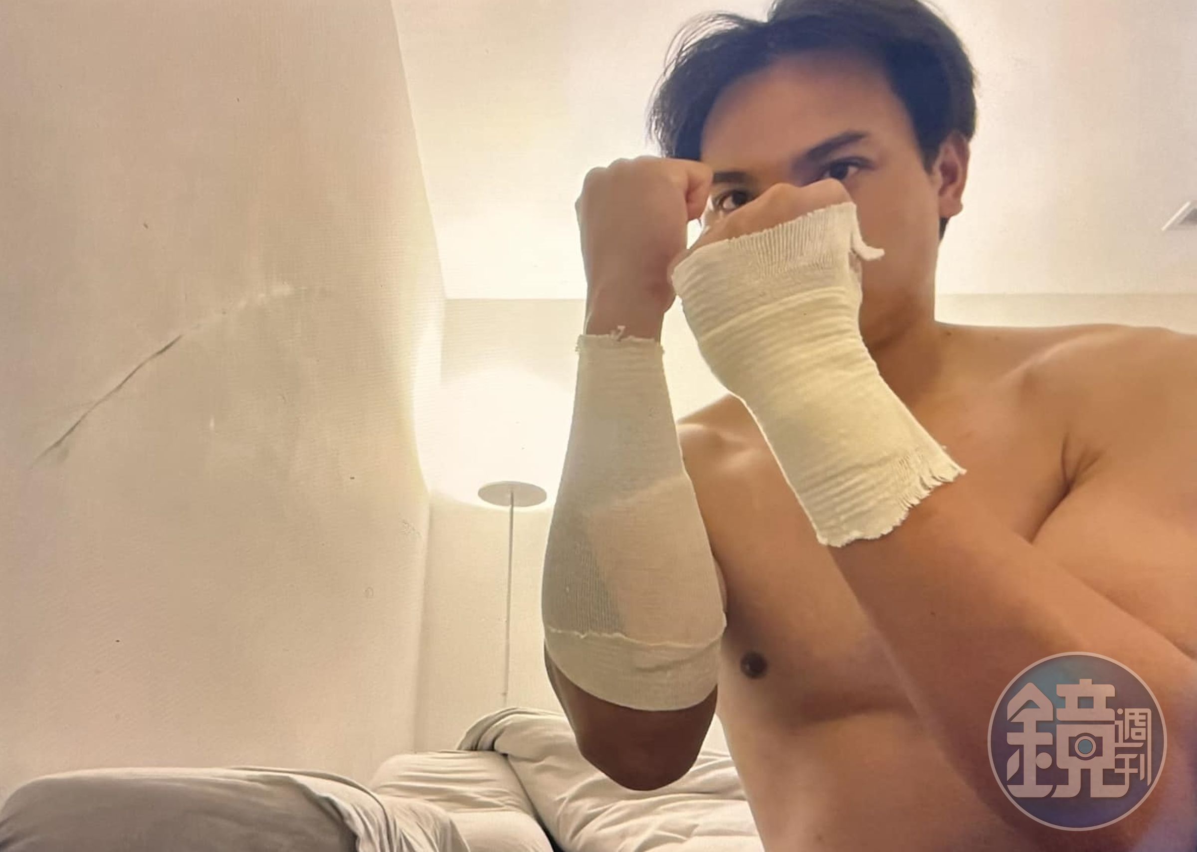 張育成手部遭觸身球集中,所幸他並無大礙,還開玩笑po出纏繞繃帶照,直呼「一秒變拳擊手」。(翻攝自張育成臉書)