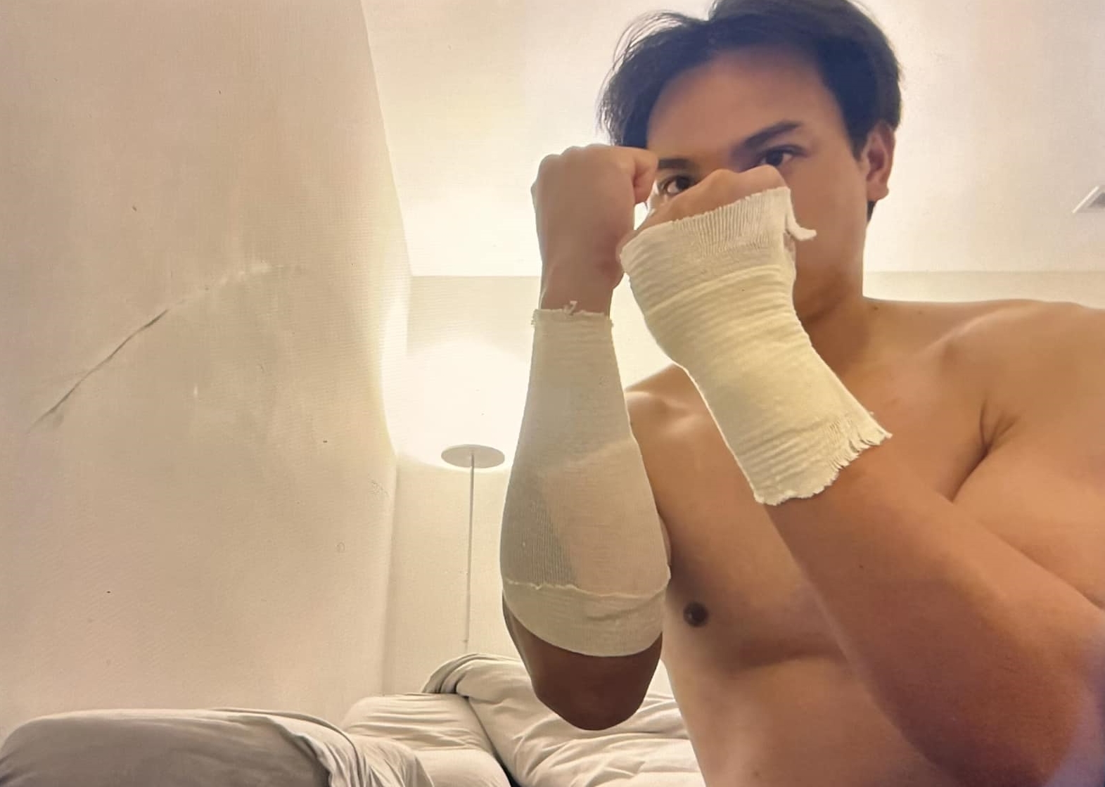 張育成手部遭觸身球集中，所幸他並無大礙，還開玩笑po出纏繞繃帶照，直呼「一秒變拳擊手」。（翻攝自張育成臉書）