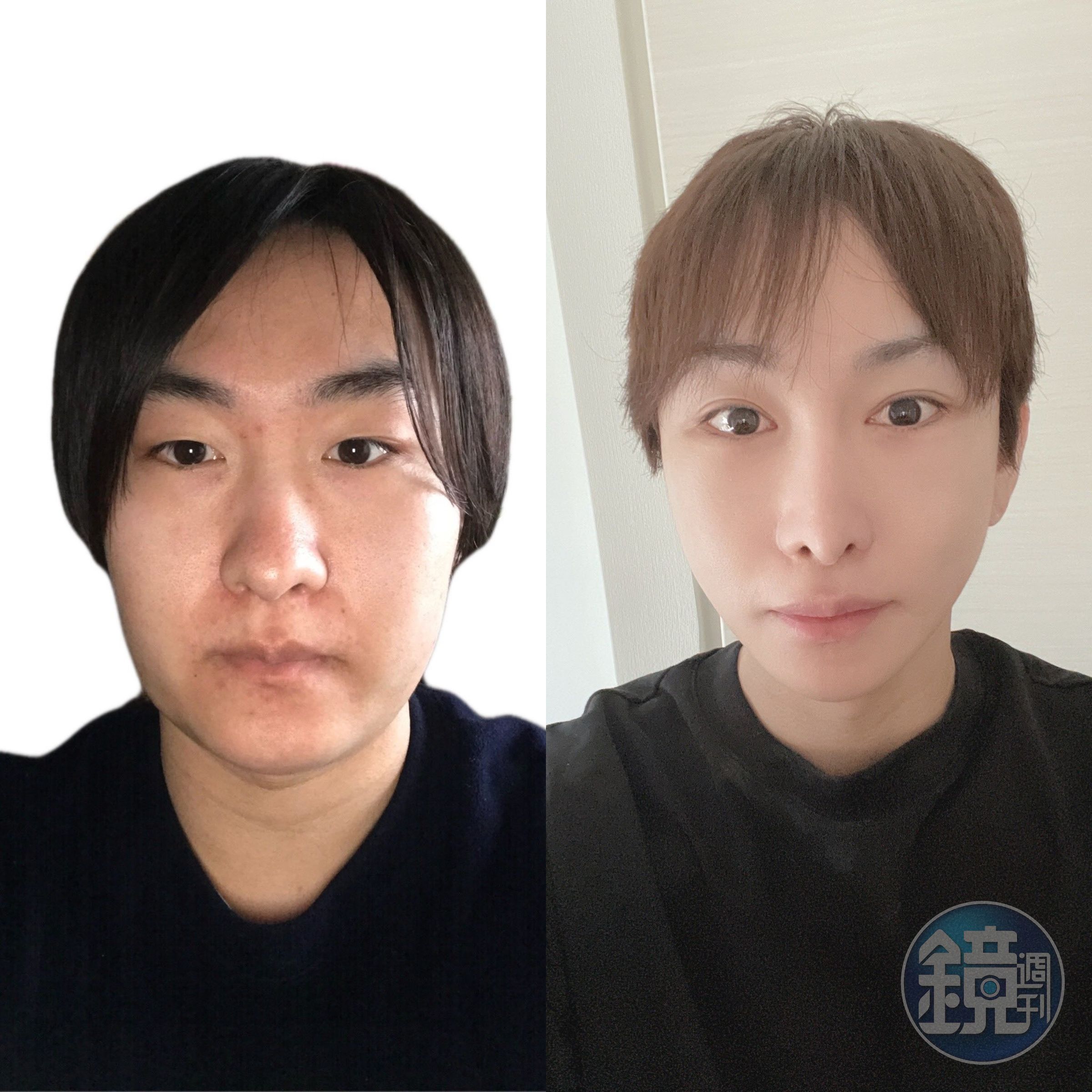 黑神YAMATO斥資5,000萬日圓整形，他也大方公開前後差異。（翻攝自黑神YAMATO Twitter）