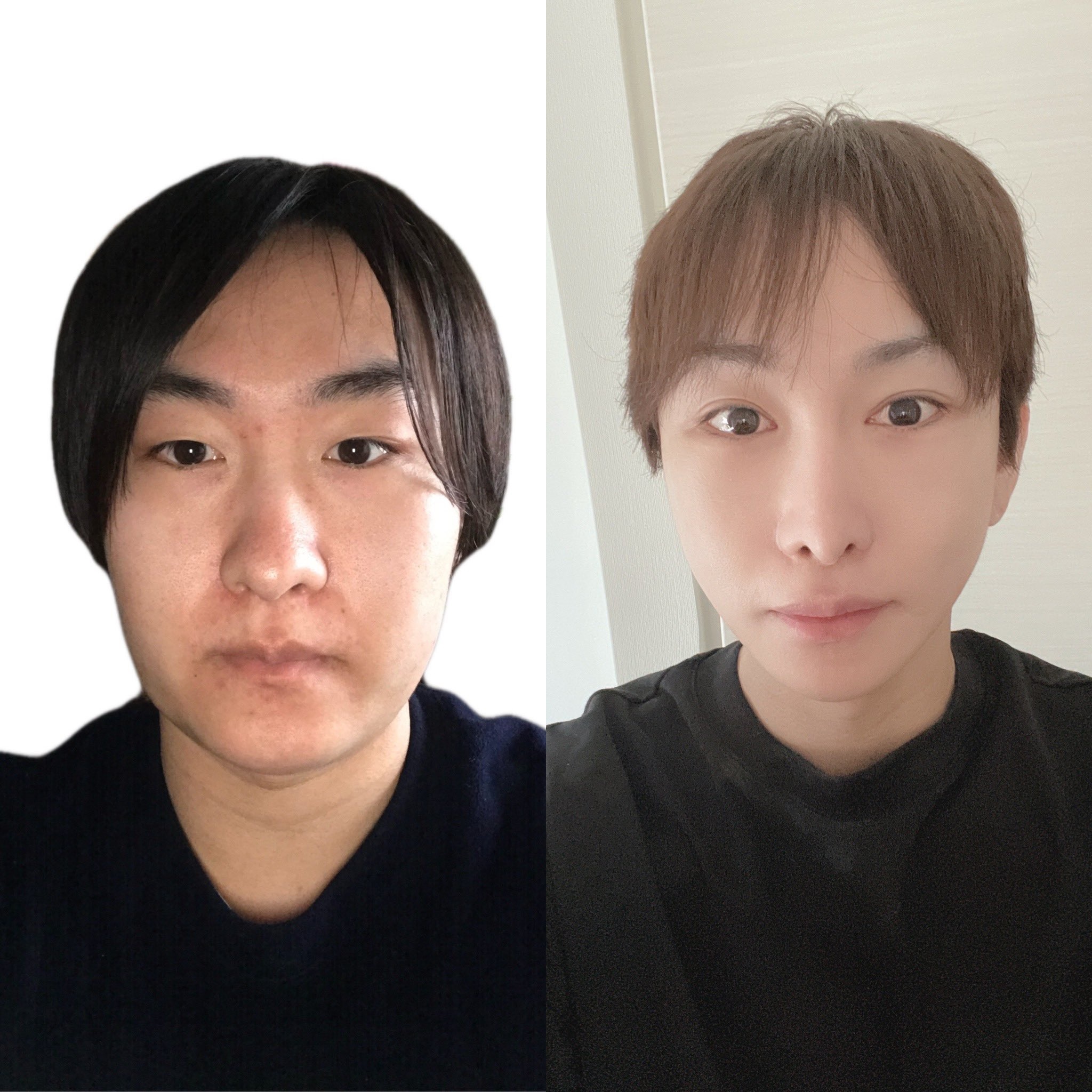 黑神YAMATO斥資5,000萬日圓整形,他也大方公開前後差異。(翻攝自黑神YAMATO Twitter)