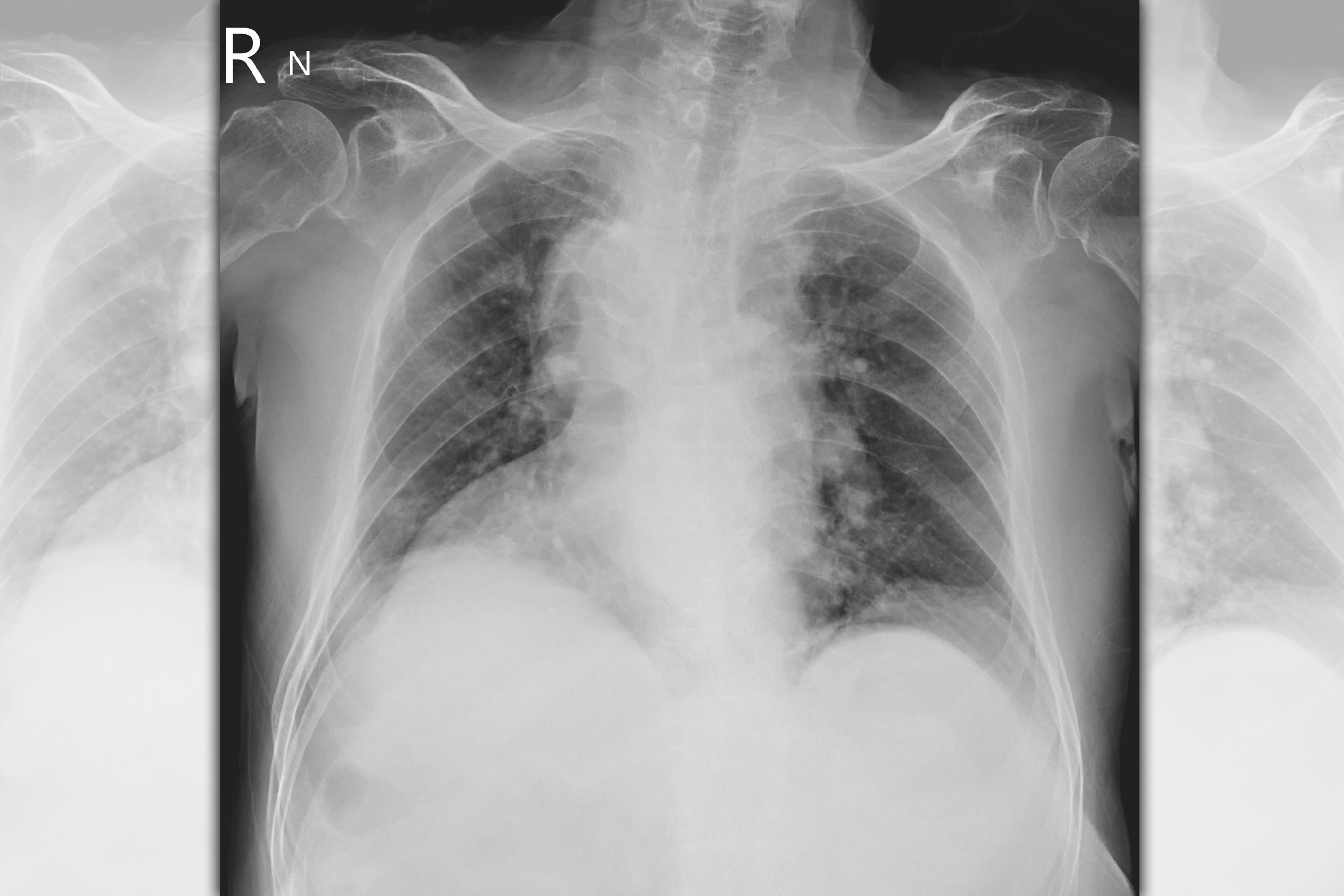 胸腔科醫師蘇一峰最近遇到一名活了70年都不知道「心臟在右邊，而肝臟在左邊」的患者。（翻攝自蘇一峰臉書）