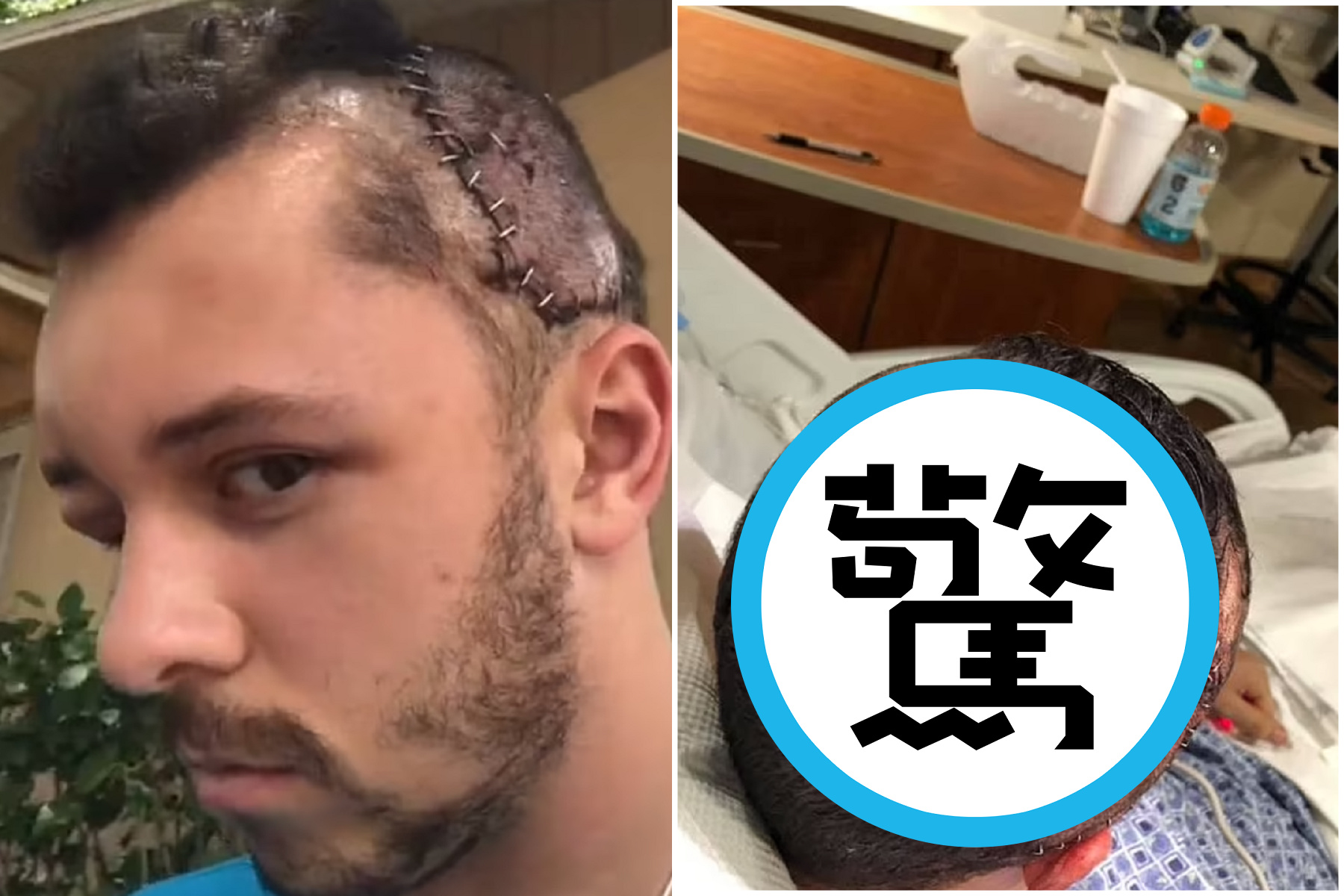 男遭鱷魚攻擊狠咬人頭，河水瞬間被染紅！血腥第一視角曝光。（翻自《每日郵報》）