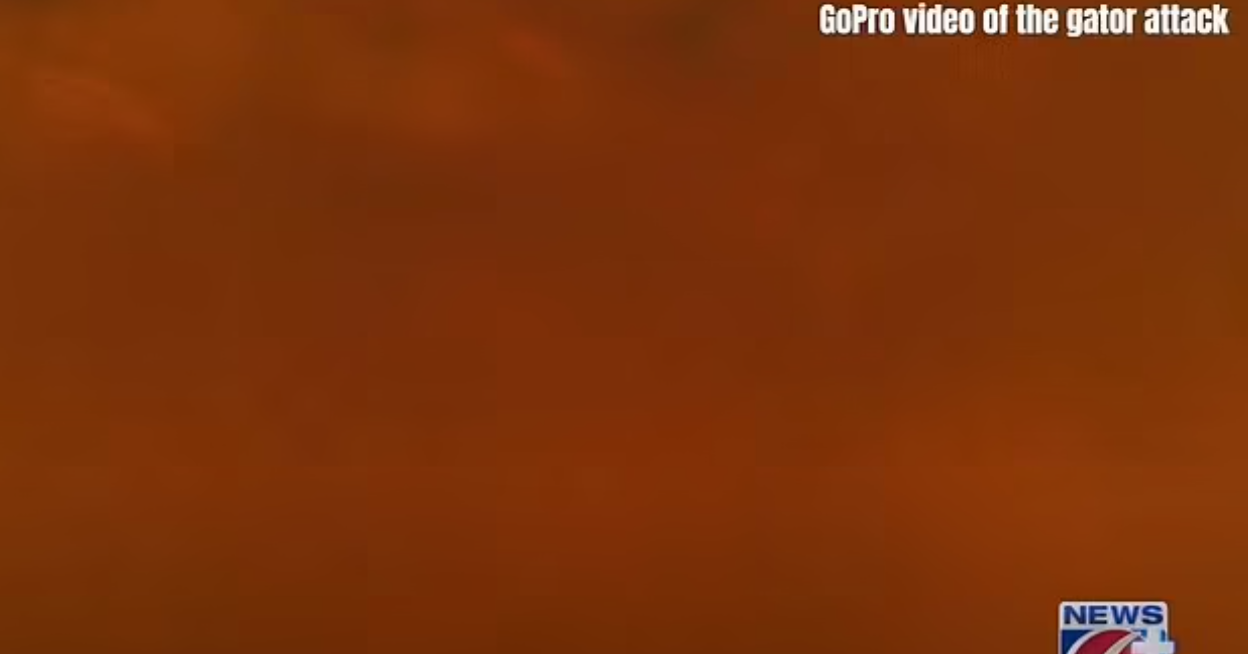 海伊姆當時下水有配戴 GoPro 鏡頭，因此鏡頭也錄下他瞬間爆血的一刻。（翻自《每日郵報》）