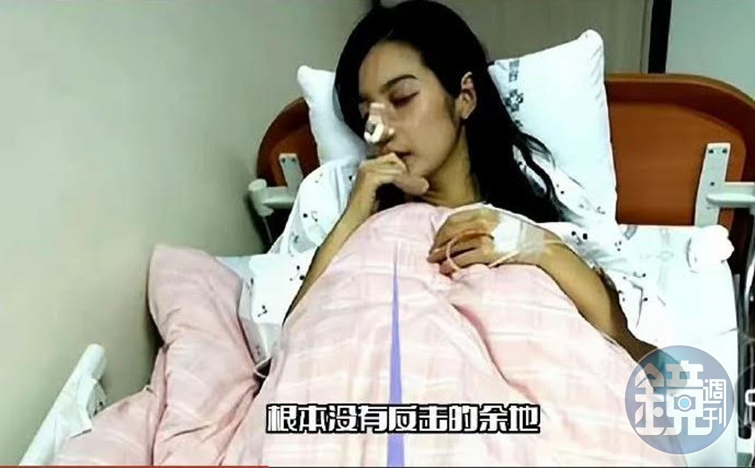 陸網Po照指林志玲被打斷鼻子,但照片中女子是韓星李敏英。(網路圖片)