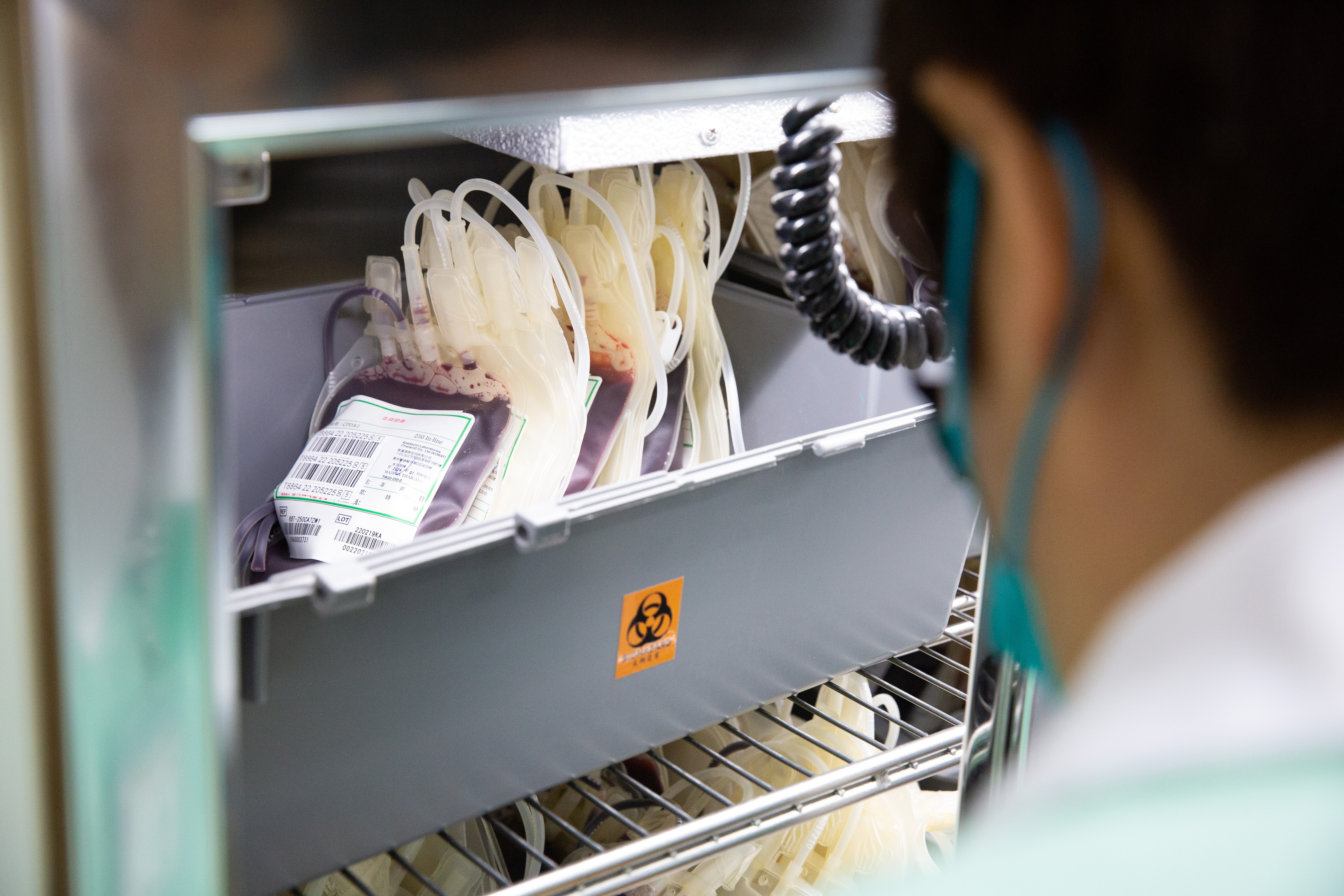 疾管署表示，若國內HIV病例降到千例以下，最快今年底專家就會討論是否放寬限制。（示意圖，本刊資料照）