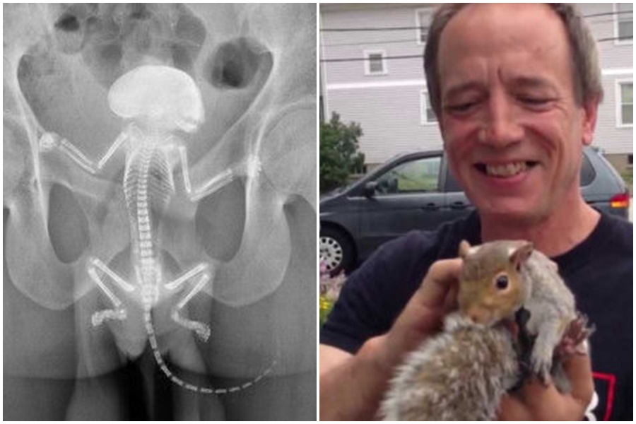 美國新罕布夏州一名60歲退休郵差，2018年因跌倒養的松鼠活生生卡進自己肛門。（翻攝自美國論壇）