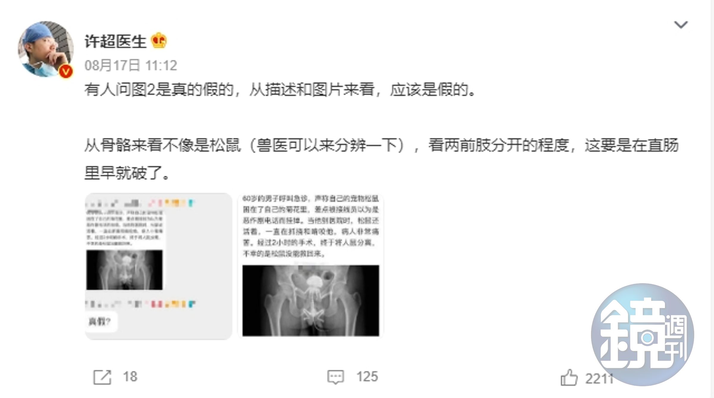 中國網紅醫師許超就直言，「看了描述和照片，就覺得應該是假的」。（翻攝自微博）