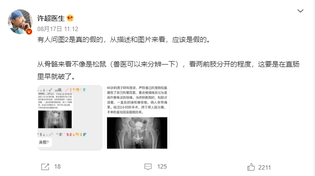 中國網紅醫師許超就直言,「看了描述和照片,就覺得應該是假的」。(翻攝自微博)