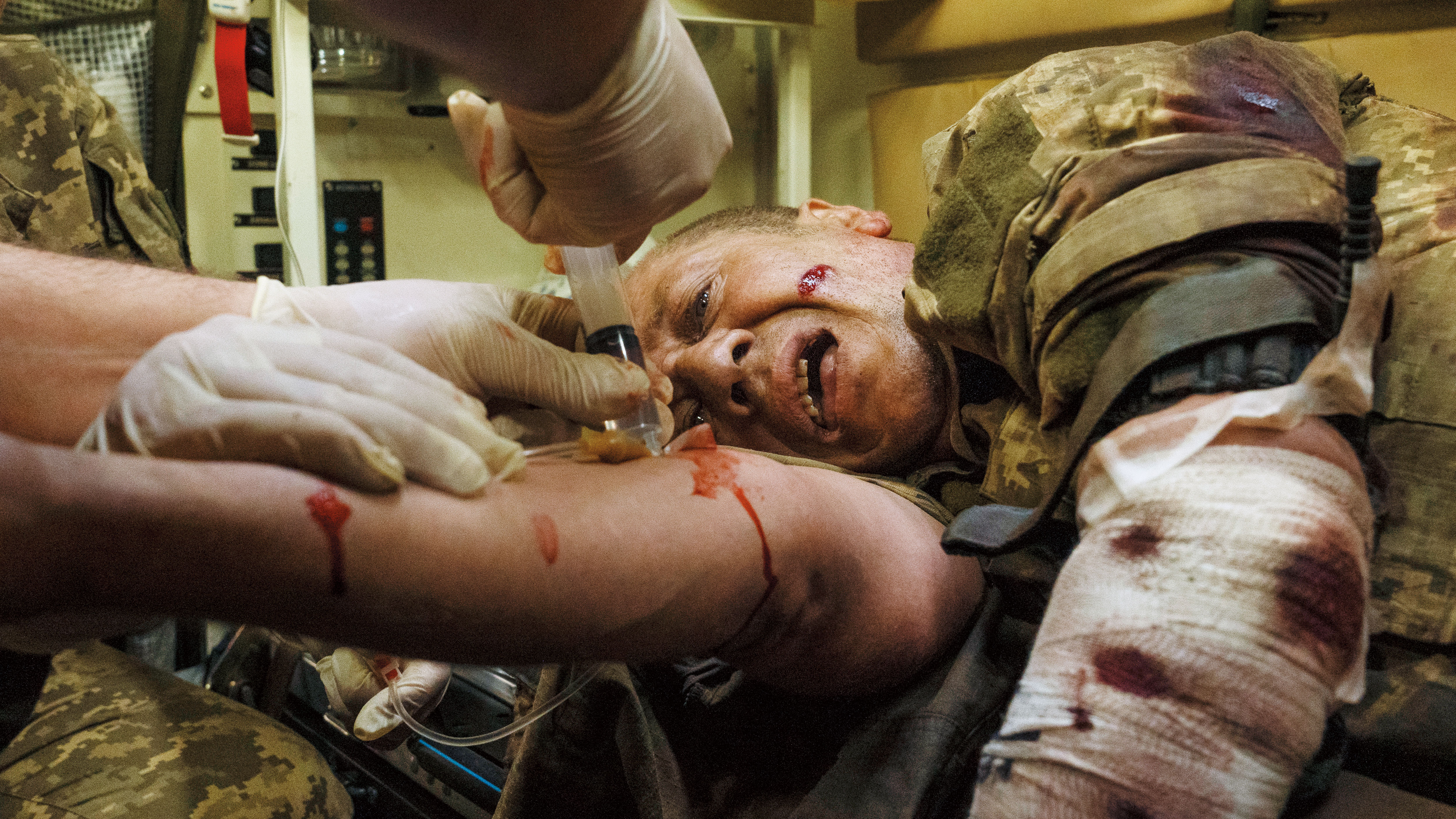 第59旅的軍醫使用創傷緊急繃帶為全身布滿了炸彈碎片的士兵纏繞傷口,傷兵的眼神中滿溢著恐慌和劇痛。