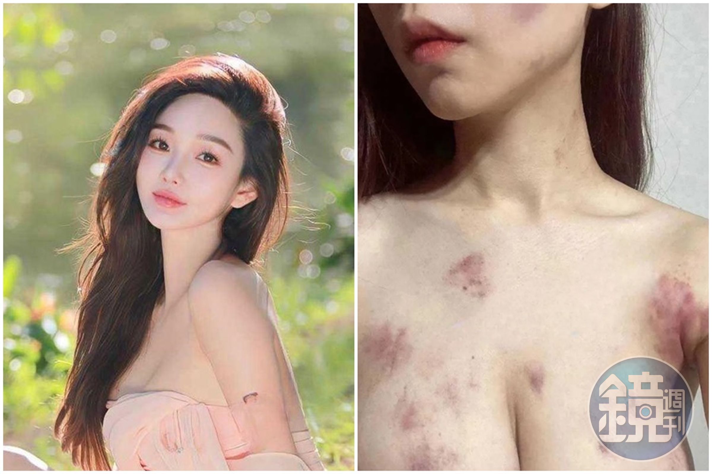 百萬網紅傳被閨密賣到東南亞「裸身瘀青照瘋傳」營救商會曝真相- 鏡週刊Mirror Media